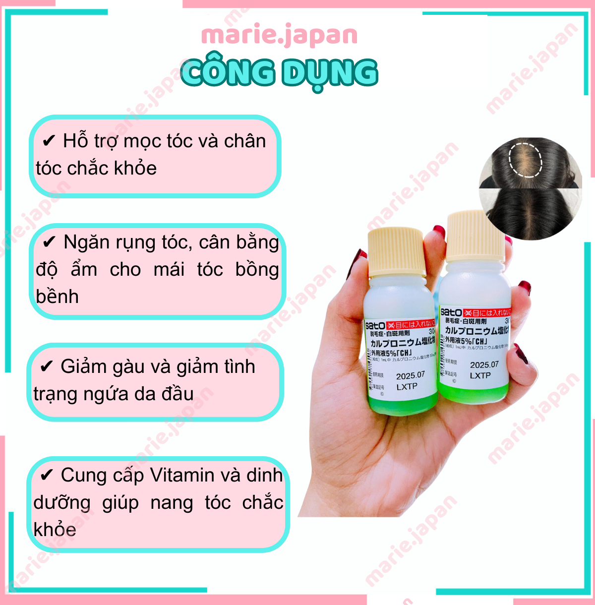 [Name Concealment] Sato Hair Growth Essence to Prevent Hair Loss 30ml Japan