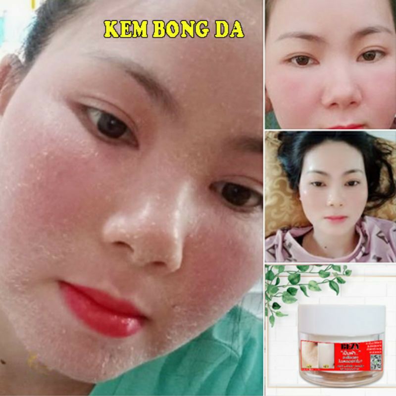 [HCM]Kem Bong Trắng Da BEZY Mờ Nám Thâm Sạm Tàn Nhang