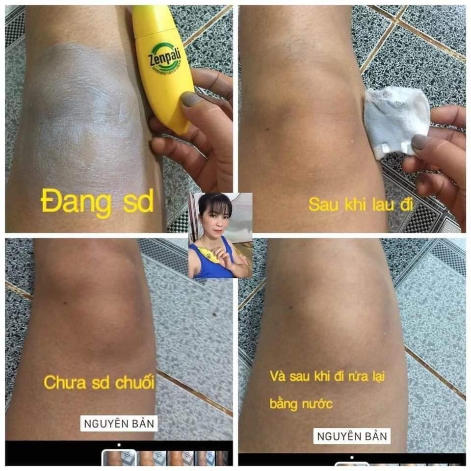 🍌🍌🍌Chuối Zenpali - Cấy trắng Detox Thải Chì Thải Độc🍌🍌🍌