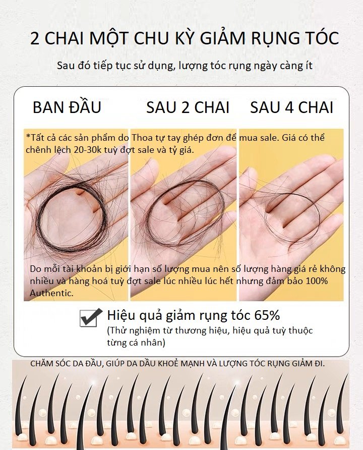 [GIẢM 5% ĐƠN 129K]Dầu gội gừng KING GINGER MOFAJANG