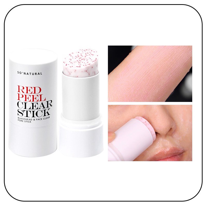 [HCM] THANH LĂN MỤN RED PEEL CLEAR STICK