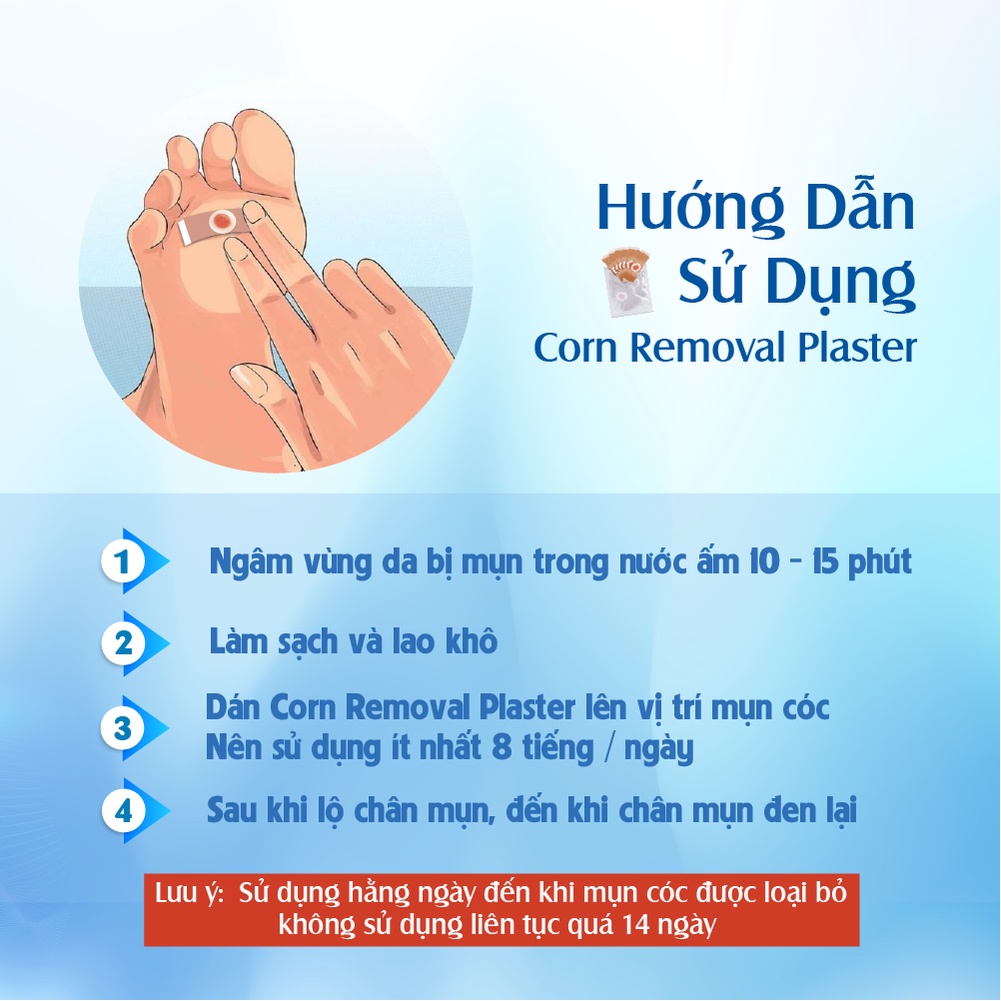 Miếng Dán Mụn Cóc Tại Nhà Corn Removal Plaster ( Hộp 6 Miếng )