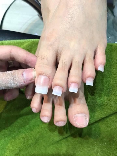 MÓNG NỐI - ĐẮP CHÂN