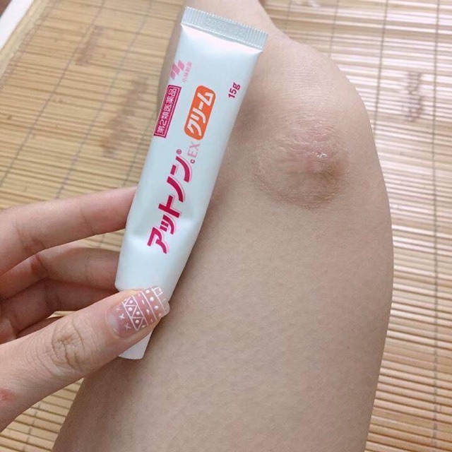 Kem mờ sẹo Kobayashi Nội địa Nhật 15g