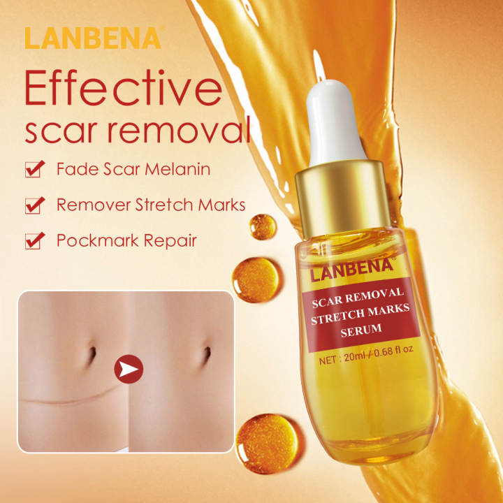 Tinh Chất Làm Mờ Sẹo Cấp Ẩm Làm Mờ Sẹo Giảm Thâm Mụn Sẹo Lâu Năm Scar Treatment Serum Lanbena 20Ml