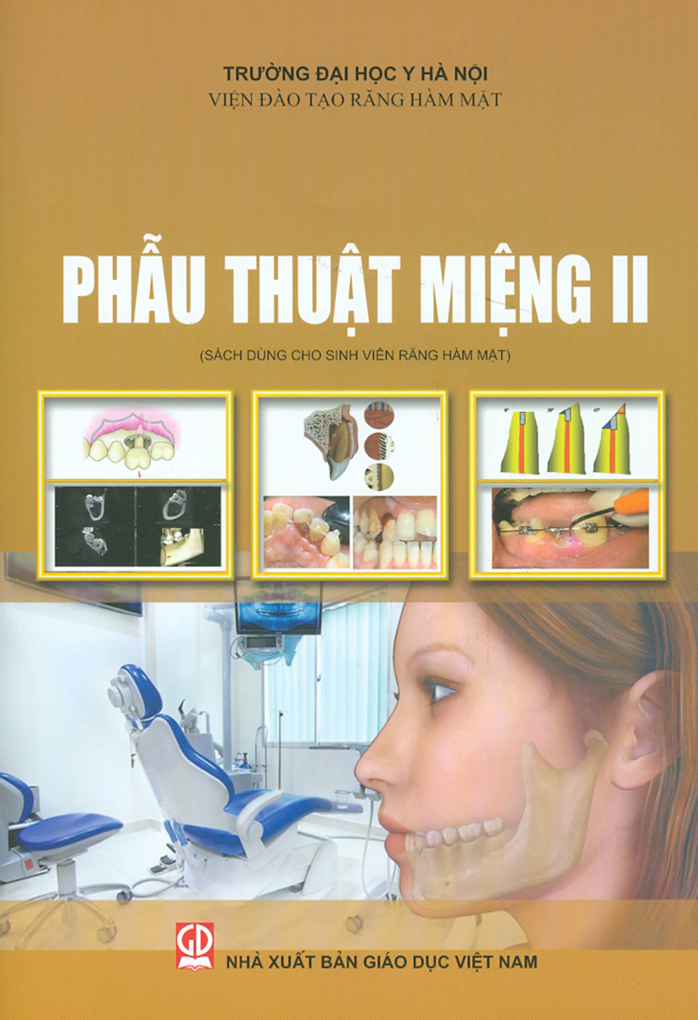 Phẫu Thuật Miệng Ii (Sách Dùng Cho Sinh Viên Răng Hàm Mặt)