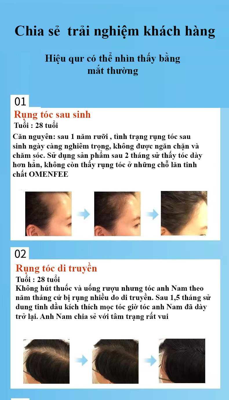 Kích Mọc Tóc OMENFEE, Serum Omenfee kích thích mọc tóc, Tinh Chất Kích Thích Mọc Tóc