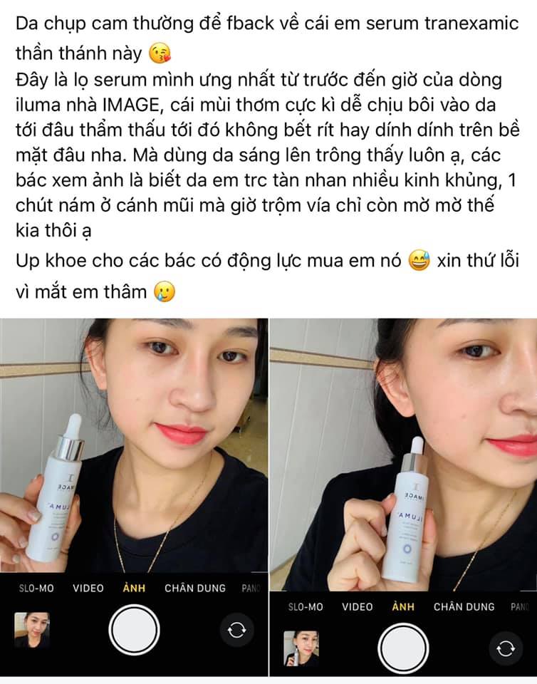 Serum giảm nám mới Image Iluma Intense Illuminator 30ml