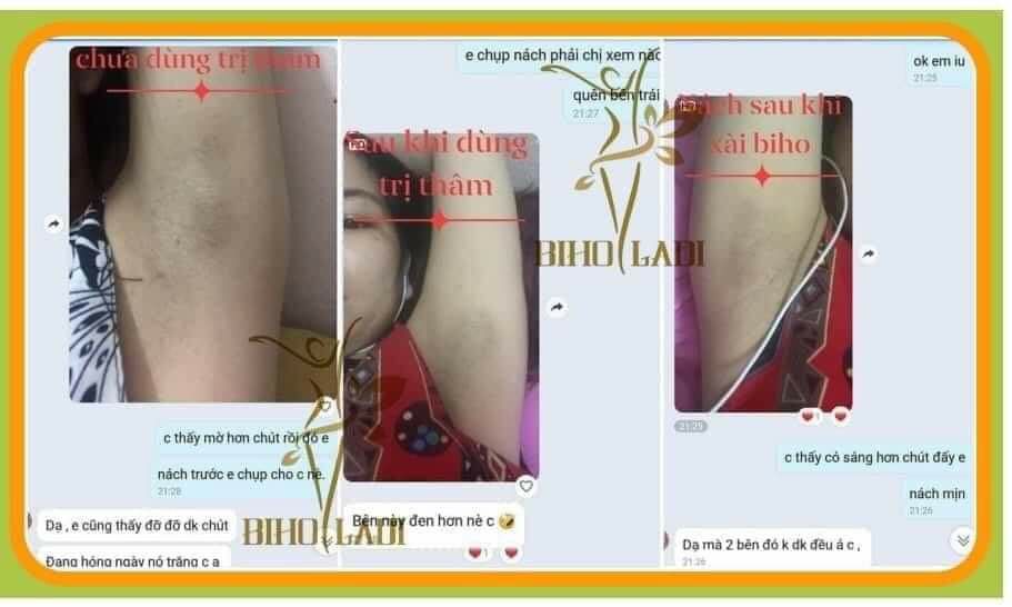 [HÀNG CHÍNH HÃNG] Siêu Dưỡng Thâm 5s Biho ladi