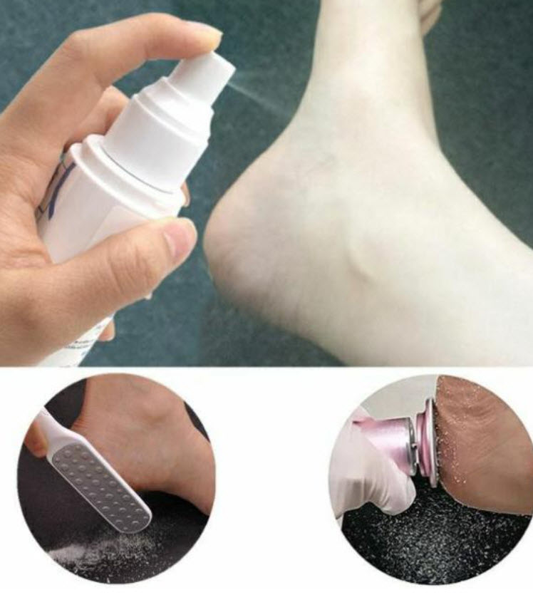 Chai Xịt, Nước Xịt Làm Mềm Da Chà Gót Chân Eleven (Sử dụng cùng Chà Gót Chân)