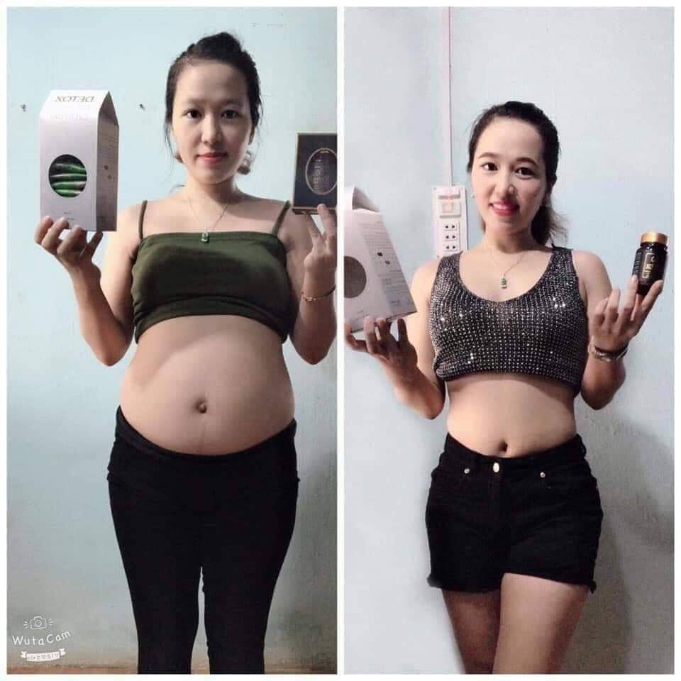 [HCM]Combo Go Detox (Mẫu Mới Nhất)