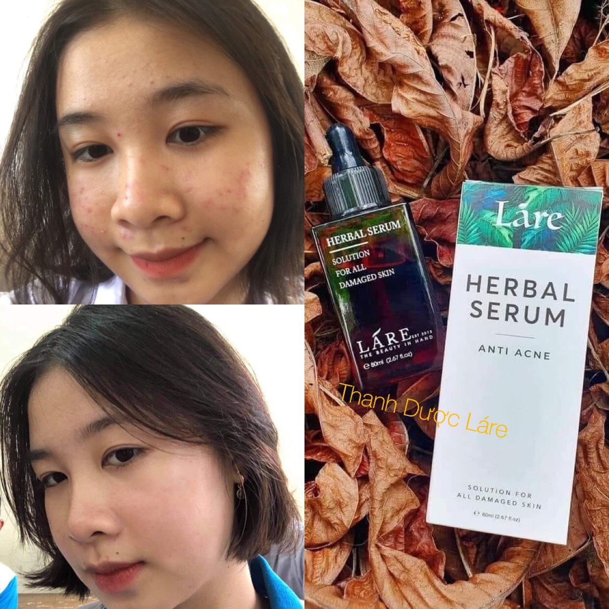 Serum thảo mộc Thanh Dược Lare chiết 40ml