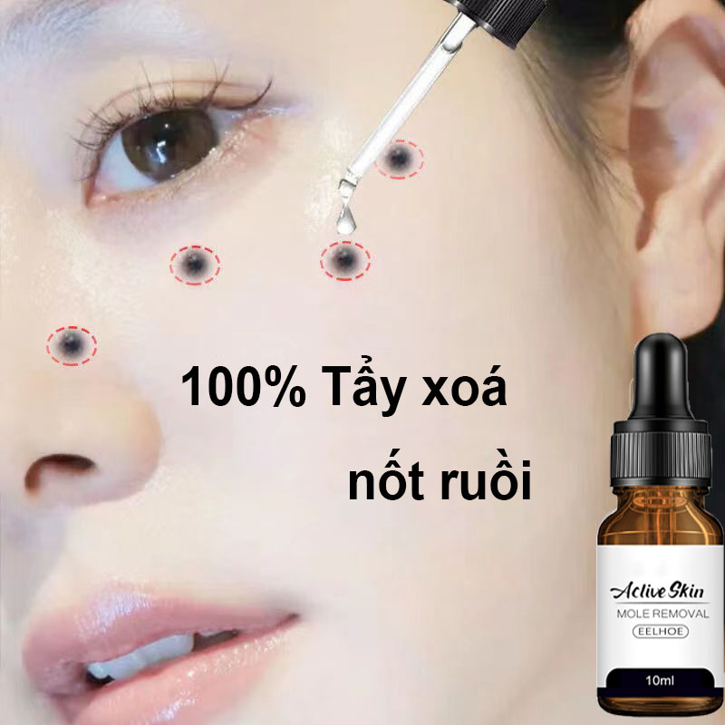 [Loại Xịn]MOLE REMOVAL serum tẩy nốt ruồi xóa mụn ruồi trên mặt, tàn nhang, mụn cóc, mụn thịt , mụn cơm