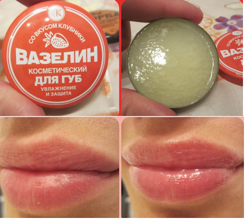 Sáp nẻ Vaseline Nga