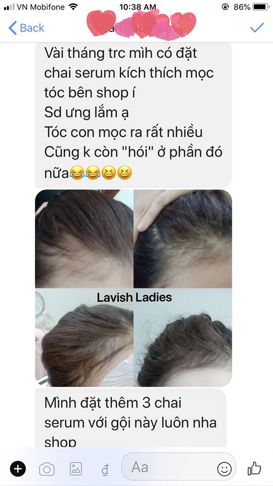 [HCM]Tinh chất kích mọc tóc cực mạnh