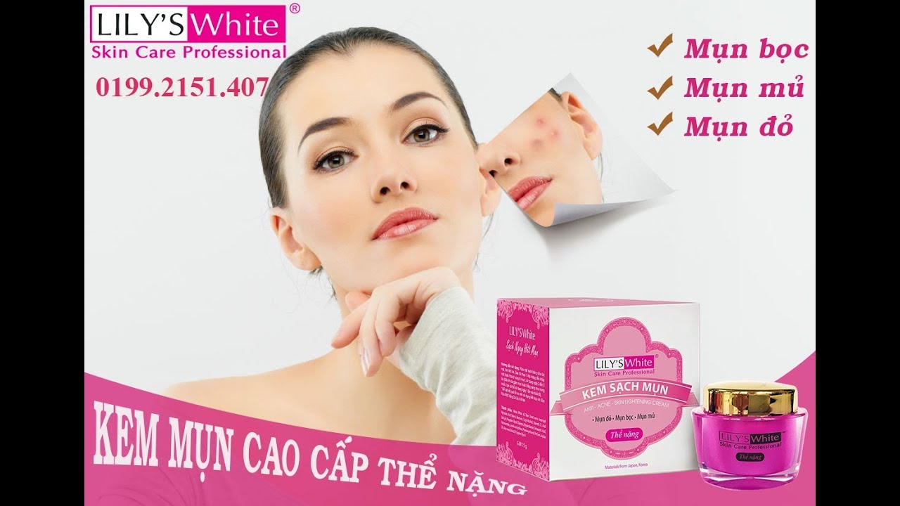 [HCM]Kem Mụn LILY'S WHITE thể nặng 16gr ( mụn bọc mụn đỏ mụn mủ )