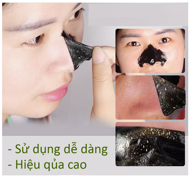 Gel lột mụn than tre hoạt tính 50gr
