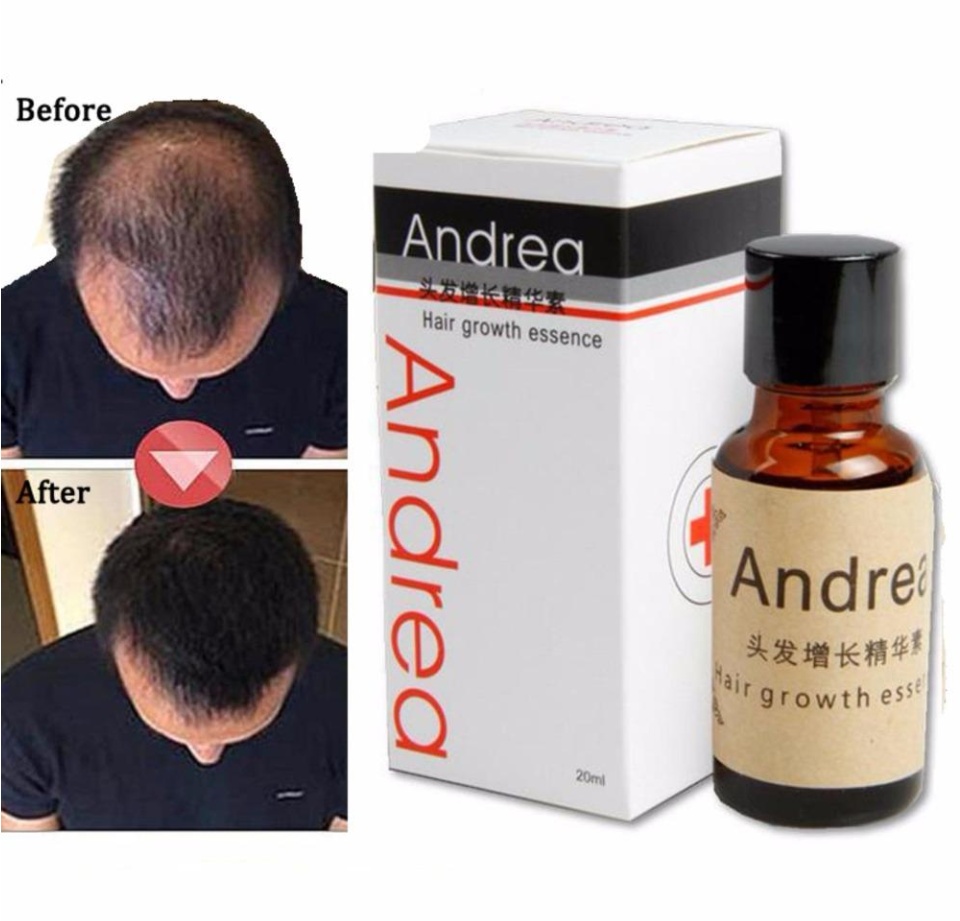 Serum mọc tóc Andrea (20ml)