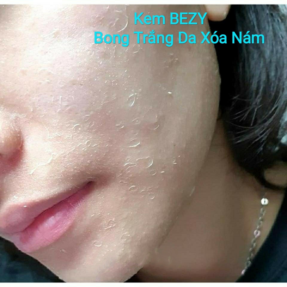 [HCM]Kem Bong Trắng Da BEZY Mờ Nám Thâm Sạm Tàn Nhang