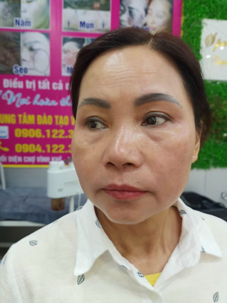 [HCM]KEM TR.I. GIÃN MAO MẠCH - THẠCH SÂM ĐỎ