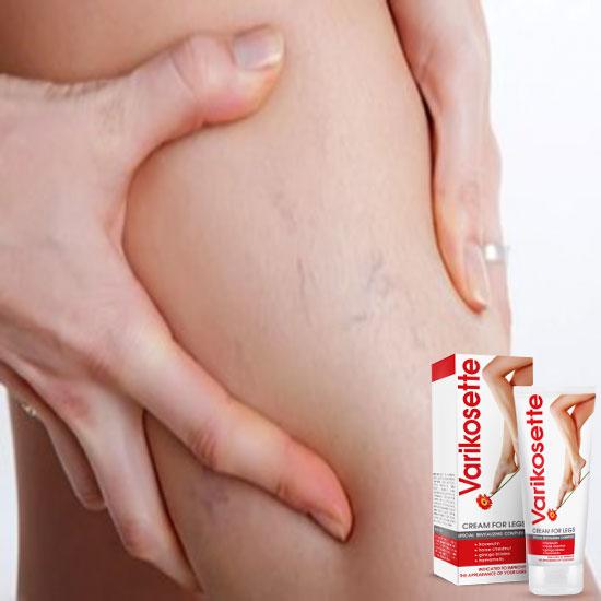 Kem giãn tĩnh mạch chân Varikosette Nga 75ml