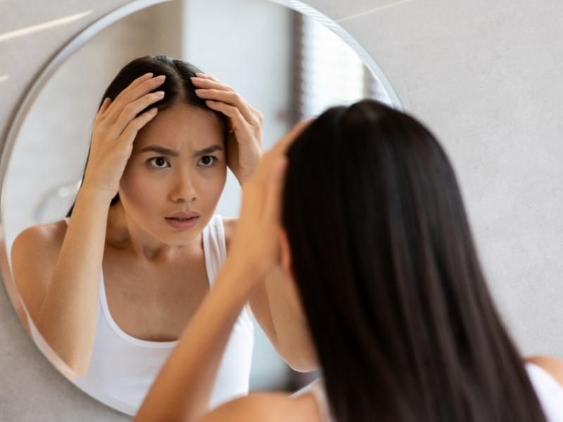 Xịt kích mọc tóc chống rụng SE Selen Compliment