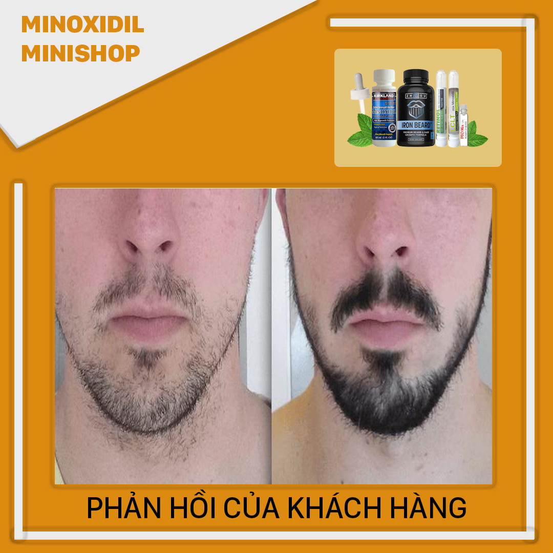 Combo Mọc Râu Tóc: Minoxidil 5% + Iron Beard + LCLT + Retinol + Peo mix