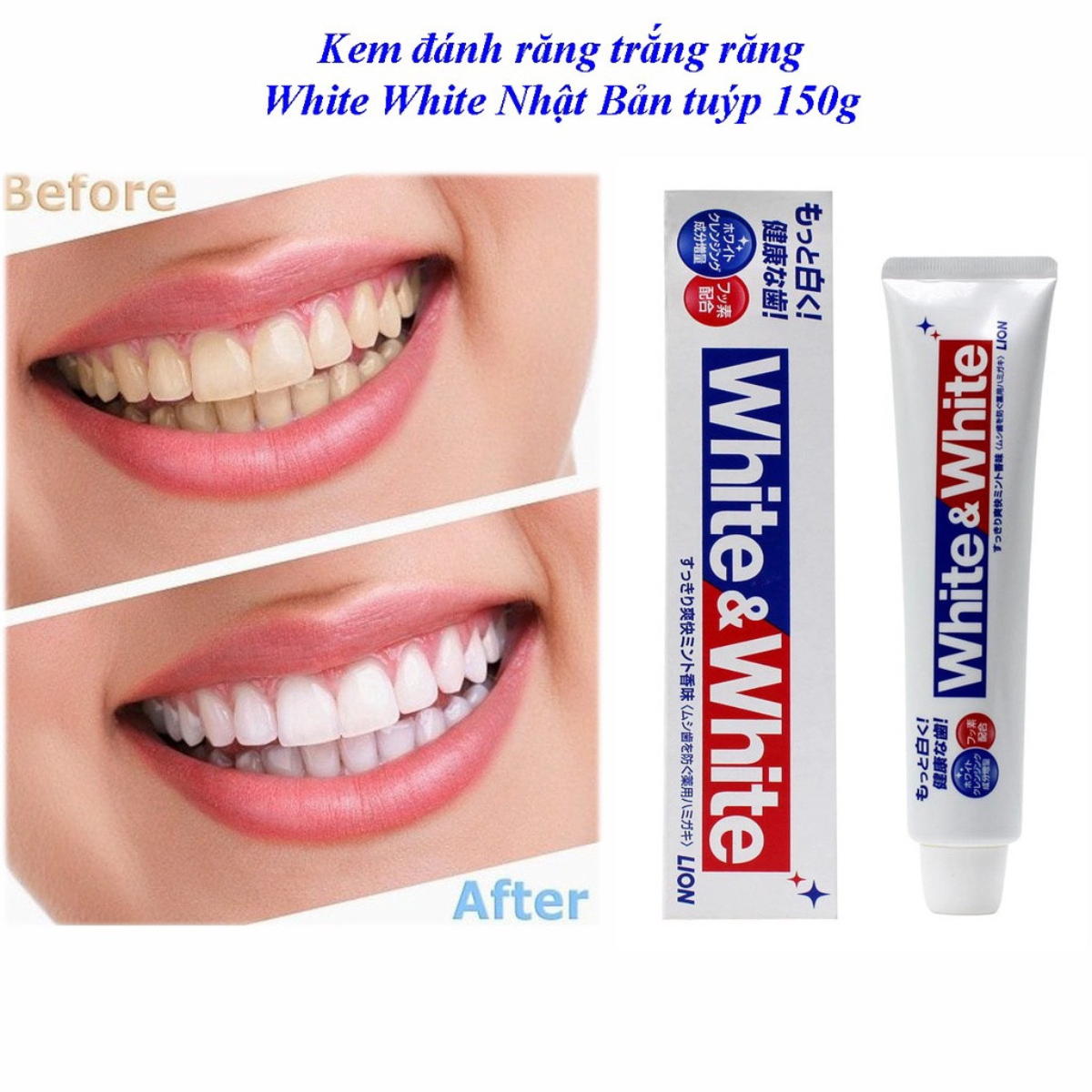 KEM ĐÁNH RĂNG WHITE & WHITE LION NHẬT BẢN