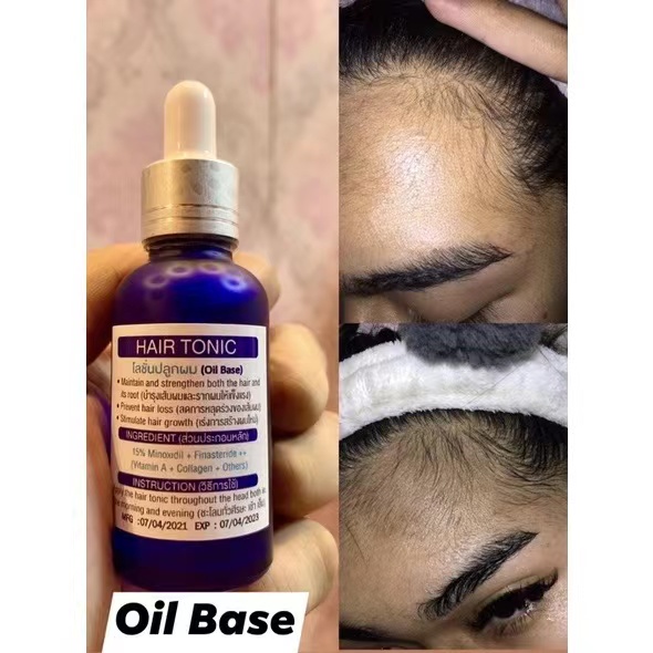 Minoxidil 15% (Bán chạy nhất) (Niêm phong) Sản xuất tại Thái Lan đích thực