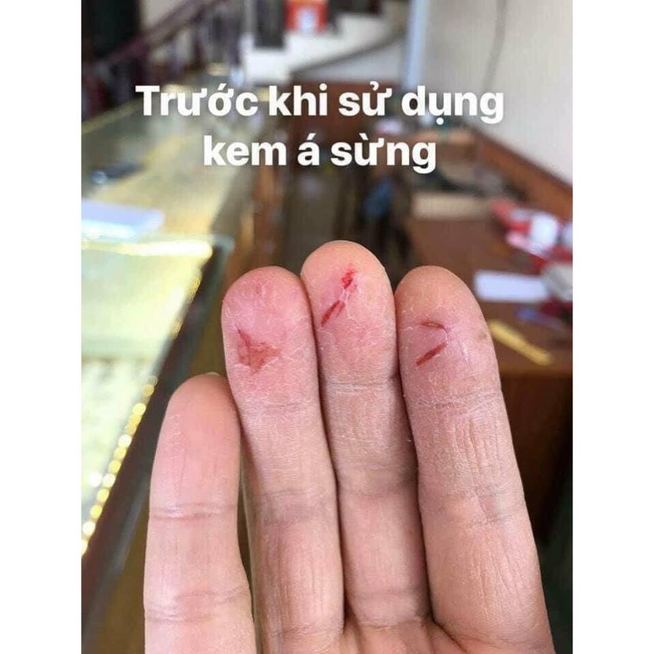 Kem á sừng Keratinamin