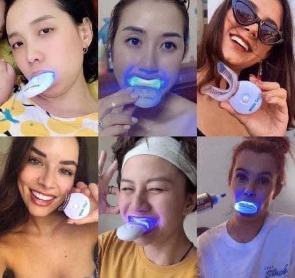 Bộ làm trắng răng White Glo White Accelerator Blue Light Teeth Úc