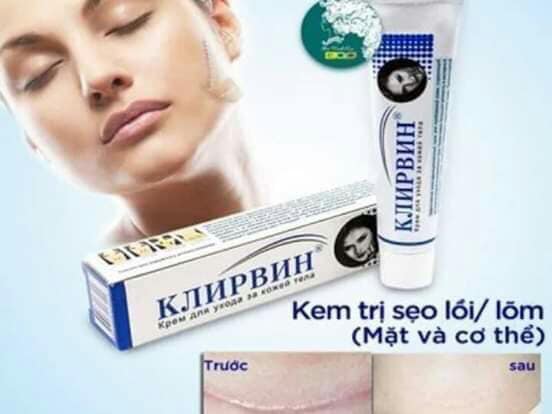[HCM]Kem làm mờ hết sẹo Nga KLIRVIN
