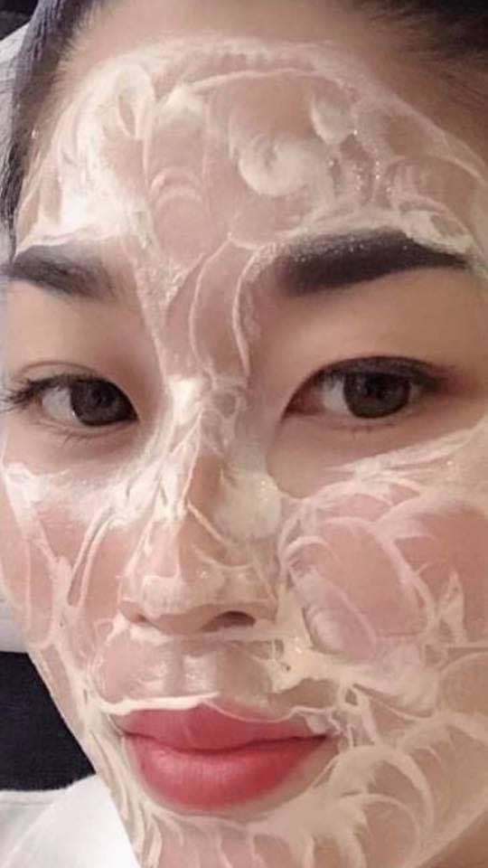 cấy trắng tổ yến