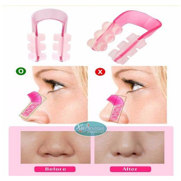 Dụng cụ kẹp nâng mũi Nose Up