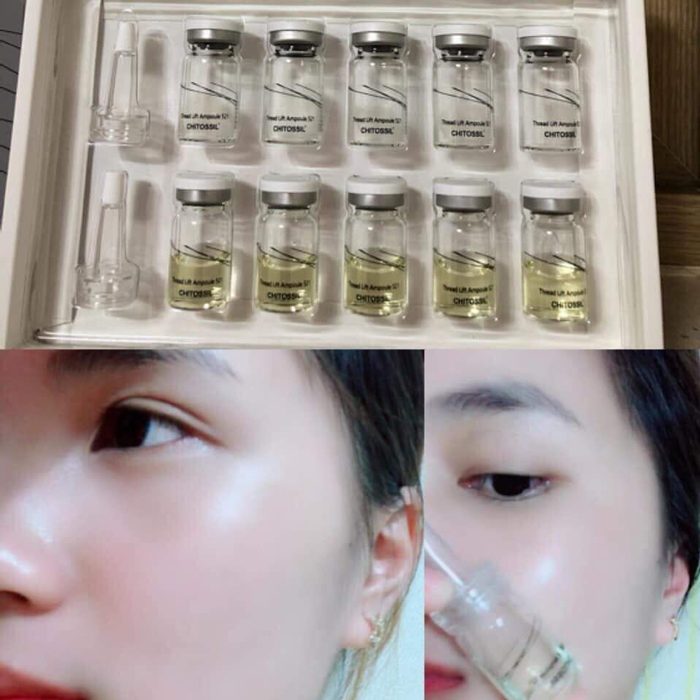 [HCM]SERUM CHỈ TƠ TẰM CHITOSSIL HÀN QUỐC
