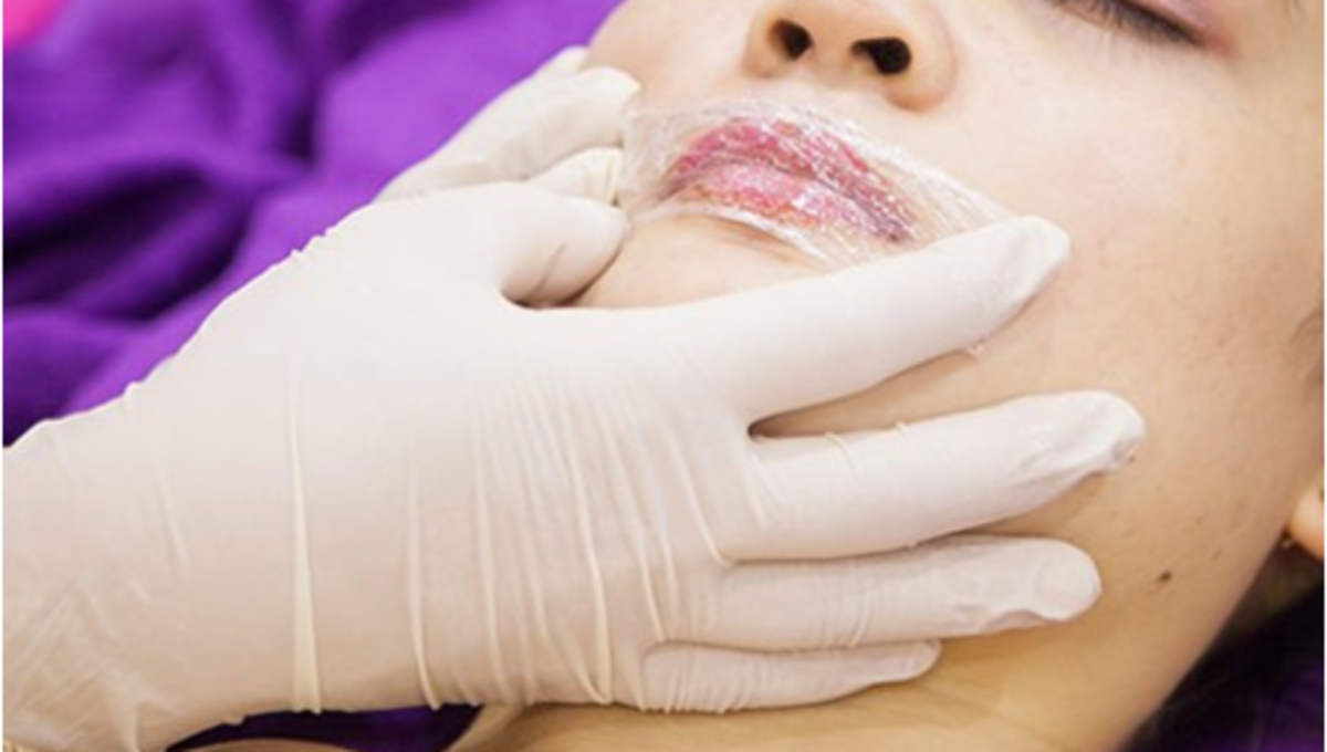 Khử thâm môi nam là gì? Tại sao đàn ông hiện đại nên thực hiện sớm 3 Ni Lông Ủ Tê Trong Phun Xăm (bản 6x6cm) | Lazada.vn