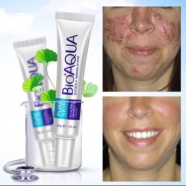 Combo Bộ  Mụn Thần Thánh Bioaqua