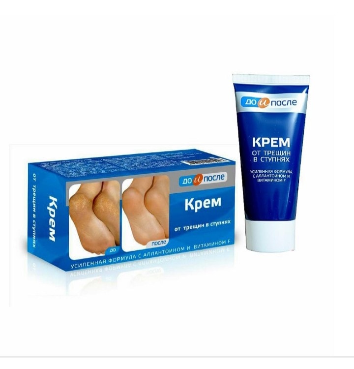 Kem nứt gót chân Kpem Apteka Nga