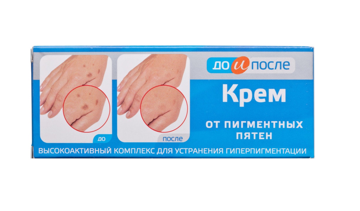[HCM]Kem Loại Bỏ Đồi Mồi Da Tay Nga Kpem 50ml