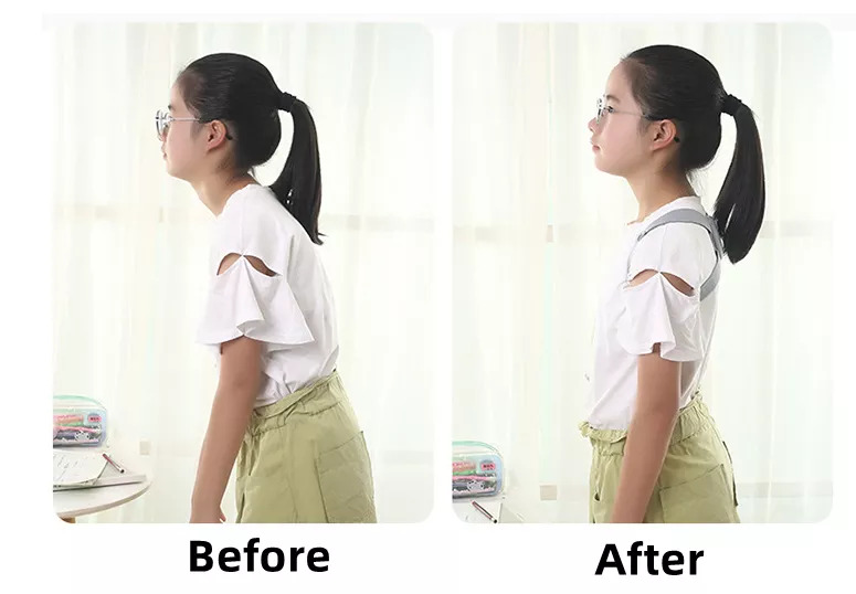 Đai gù lưng, đai chống gù lưng cho mọi lứa tuổi