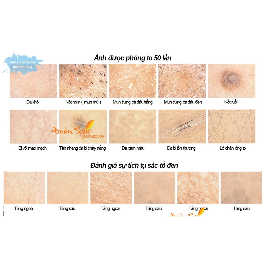 Máy soi da màn hình 9inch chụp ảnh