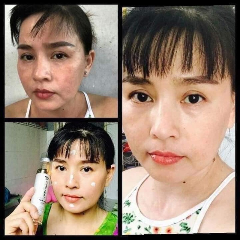 [HCM]Ủ Trắng Kén Tằm LSkin Đan Thy Group