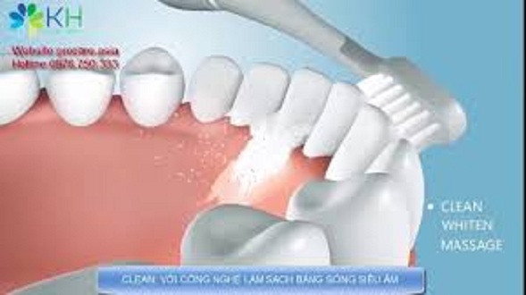 Bàn Chải Đánh Răng Điện Procare KHB02