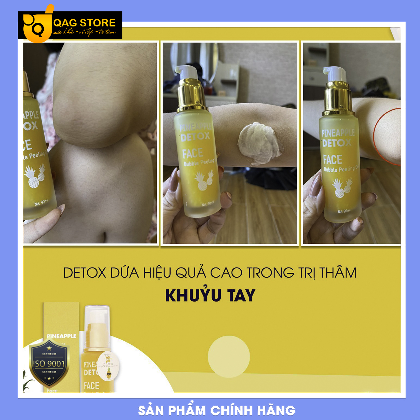 [HCM]THẢI ĐỘC DA DETOX DỨA