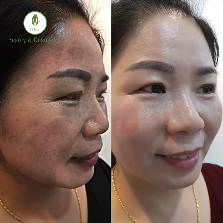SÂM ĐẾ VƯƠNG OLIC (MỸ PHẨM CHÍNH HÃNG)