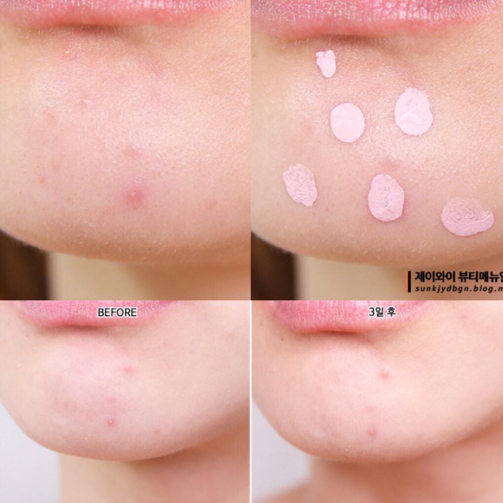 Dung Dịch Chấm Mụn Mediheal A-Zero Shot Skin Control Pink Dressing 13g
