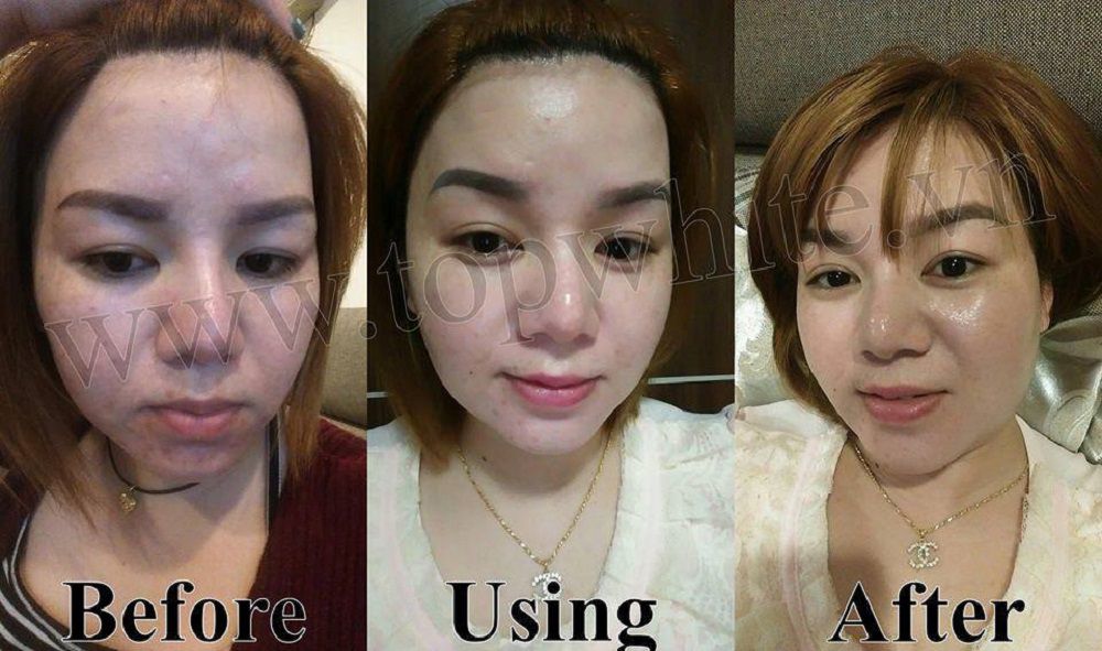 [HCM]WHITE PERFECT D2 KEM DƯỠNG TRẮNG DA BAN ĐÊM