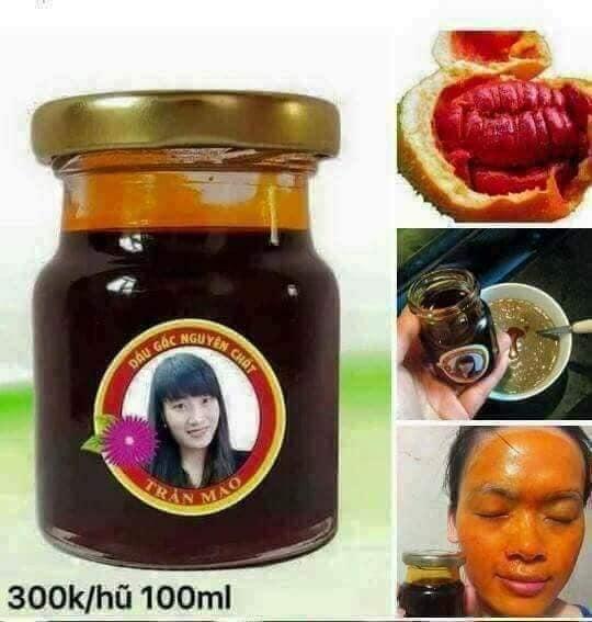 DẦU GẤC EP LẠNH TRẦN MAO 70ml
