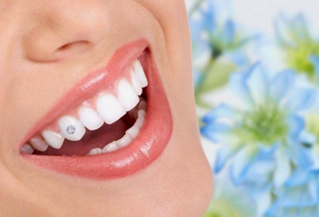 [HCM]Đá kim cương nhân tạo dán răng đế bằng hạt rời 2.75 ly