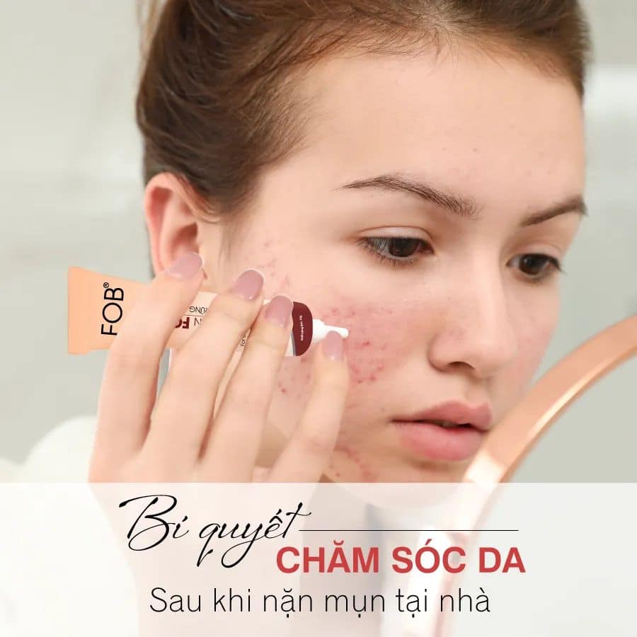 Chấm mụn FOB 10 Lotion